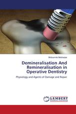 Demineralisation And Remineralisation in Operative Dentistry