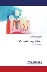 Osseointegration