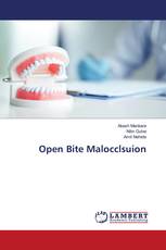 Open Bite Malocclsuion