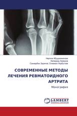 СОВРЕМЕННЫЕ МЕТОДЫ ЛЕЧЕНИЯ РЕВМАТОИДНОГО АРТРИТА