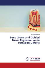 Bone Grafts and Guided Tissue Regeneration in Furcation Defects