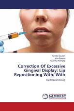 Correction Of Excessive Gingival Display: Lip Repositioning With/ With