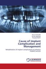 Cause of Implant Complication and Management