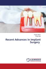 Recent Advances in Implant Surgery