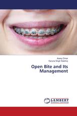 Open Bite and Its Management