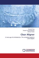 Clear Aligner