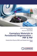Exemplary Materials in Periodontal Regeneration – PRP & PRF