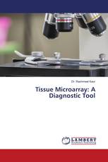 Tissue Microarray: A Diagnostic Tool