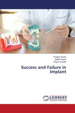 Success and Failure in Implant