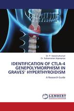 IDENTIFICATION OF CTLA-4 GENEPOLYMORPHISM IN GRAVES’ HYPERTHYROIDISM