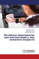 Лечебные мероприятия при имплантации у лиц пожилого возраста