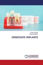 IMMEDIATE IMPLANTS