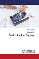 Guided Implant Surgery