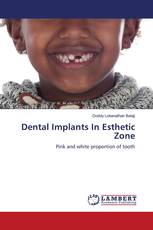 Dental Implants In Esthetic Zone