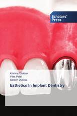 Esthetics In Implant Dentistry