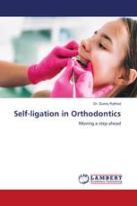 Self-ligation in Orthodontics