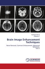 Brain Image Enhancement Techniques