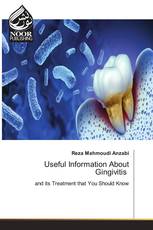 Useful Information About Gingivitis