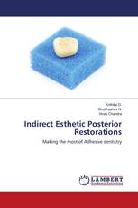 Indirect Esthetic Posterior Restorations