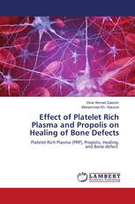 Effect of Platelet Rich Plasma and Propolis on Healing of Bone Defects