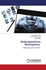 Anteroposterior Discrepancy