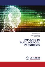 IMPLANTS IN MAXILLOFACIAL PROSTHESES