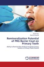 Remineralization Potential of PRG Barrier Coat on Primary Teeth