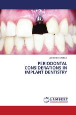 PERIODONTAL CONSIDERATIONS IN IMPLANT DENTISTRY