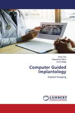 Computer Guided Implantology
