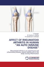 AFFECT OF RHEUMATOID ARTHRITIS IN HUMAN “AN AUTO IMMUNE DISEASE”