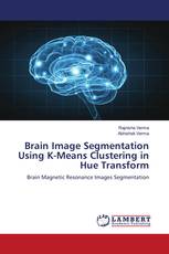 Brain Image Segmentation Using K-Means Clustering in Hue Transform