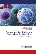 Comprehensive Review on Oral Lichenoid Mucositis:
