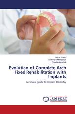 Evolution of Complete Arch Fixed Rehabilitation with Implants