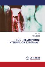 ROOT RESORPTION: INTERNAL OR EXTERNAL?