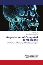 Interpretation of Computed Tomography