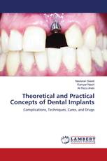 Theoretical and Practical Concepts of Dental Implants