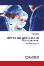 Cleft lip and palate and its Management