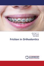 Friction in Orthodontics