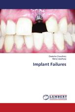 Implant Failures