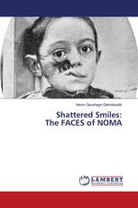 Shattered Smiles: The FACES of NOMA