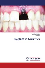 Implant in Geriatrics