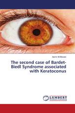 The second case of Bardet-Biedl Syndrome associated with Keratoconus