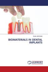 BIOMATERIALS IN DENTAL IMPLANTS