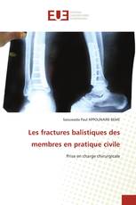 Les fractures balistiques des membres en pratique civile