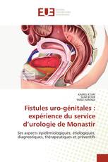 Fistules uro-génitales : expérience du service d’urologie de Monastir