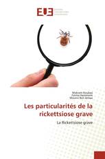 Les particularités de la rickettsiose grave