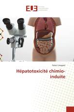 Hépatotoxicité chimio-induite