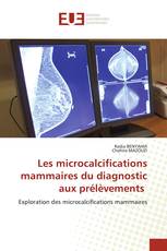 Les microcalcifications mammaires du diagnostic aux prélèvements