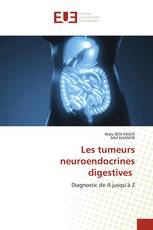 Les tumeurs neuroendocrines digestives