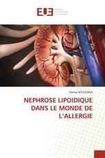 NEPHROSE LIPOIDIQUE DANS LE MONDE DE L’ALLERGIE